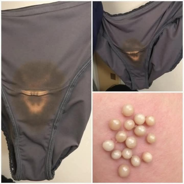 BE CAREFUL, if you notice this in your underwear, it means you have Ca…see more