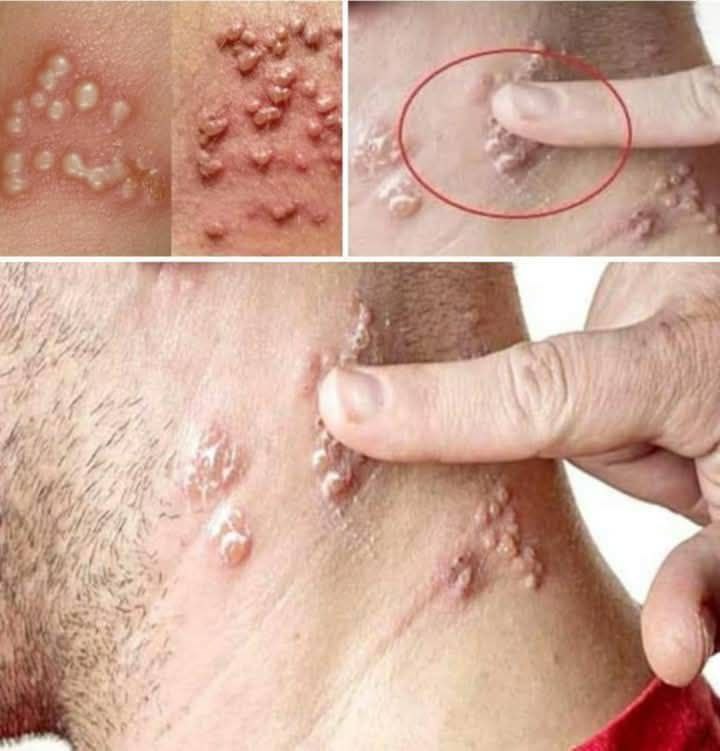 BE CAREFUL, if you notice this in your underwear, it means you have Ca…see more